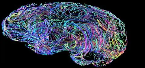 Neurons in a dish learn to play Pong