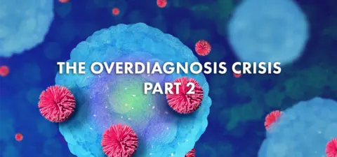 Cancer screening harms more people than it saves
