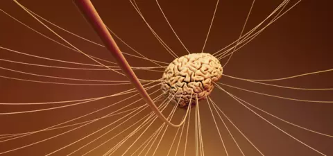 The future of AI is analogue
