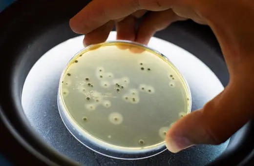 A hand holds a petri dish containing a yellowish growth medium with small colonies, illuminated from below, likely indicating a microbial culture.
